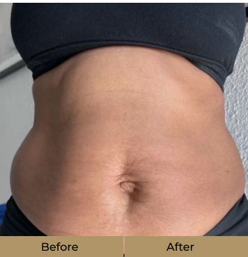 before-after-1-a