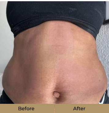 before-after-1-b