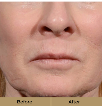 before-after-2-a