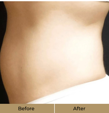 before-after-5-b